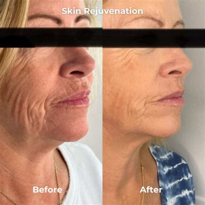 See Before & After Pics Of Her Amazing Makeover – Hollywood Life